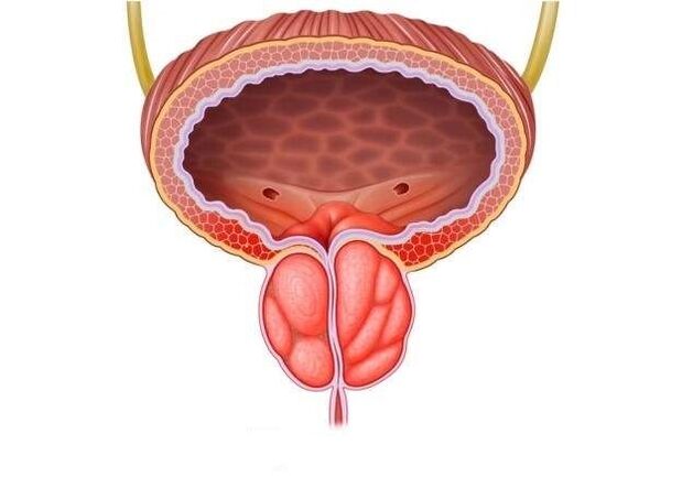 inflammation of the prostate in men